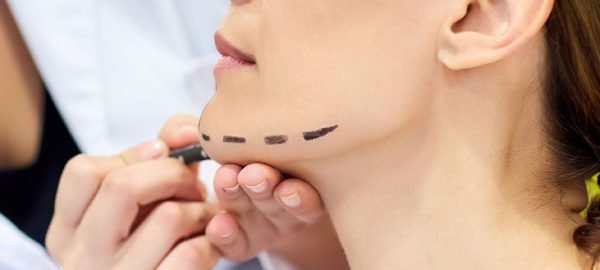 face lift surgery in Delhi