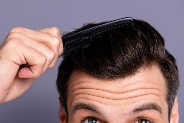 Hair transplant in East Delhi