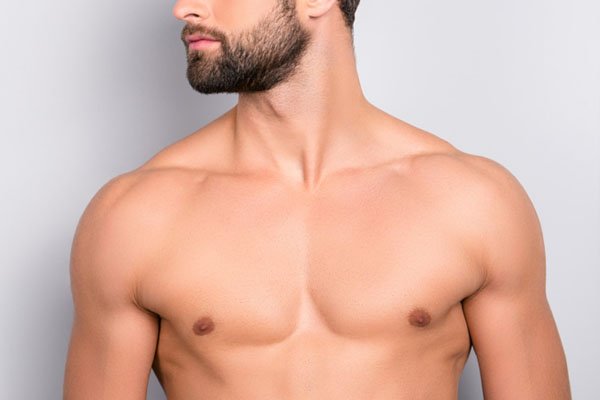 gynecomastia surgery in Delhi