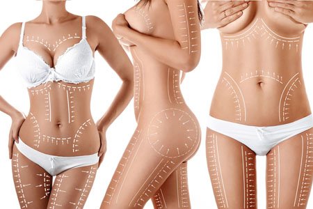 liposuction in Karnal