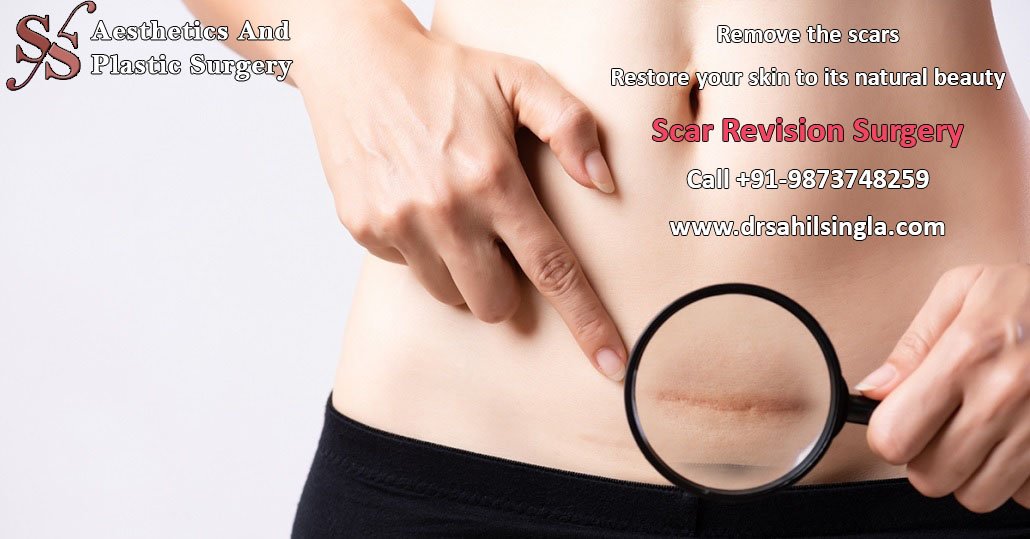 scar revision in panipat