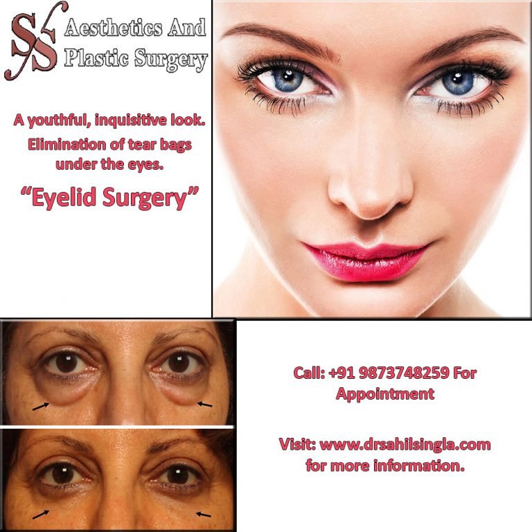 eyelid surgery