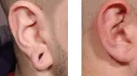 Ear