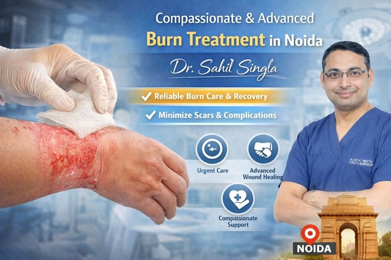 burn treatment in noida
